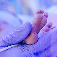 Prematüre Bebek <br>İzlemi